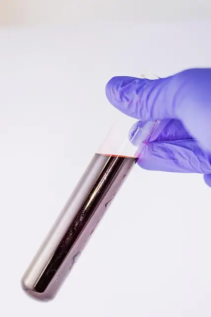 blood cholesterol testing